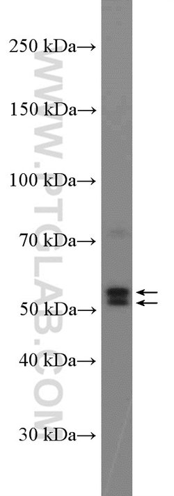 Pancreatic Lipase Rabbit anti-Human, Mouse, Rat, Polyclonal, Proteintech:Antibodies:Primary