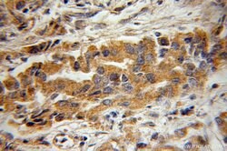 BIN3 Rabbit anti-Human, Mouse, Rat, Polyclonal, Proteintech:Antibodies:Primary