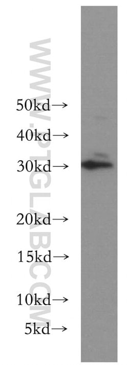 BIN3 Rabbit anti-Human, Mouse, Rat, Polyclonal, Proteintech:Antibodies:Primary