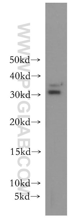 BIN3 Rabbit anti-Human, Mouse, Rat, Polyclonal, Proteintech:Antibodies:Primary
