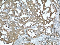 ALDOA Rabbit anti-Human, Mouse, Rat, Polyclonal, Proteintech 150 &mu;L;