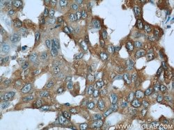 ALDOA Rabbit anti-Human, Mouse, Rat, Polyclonal, Proteintech 150 &mu;L;