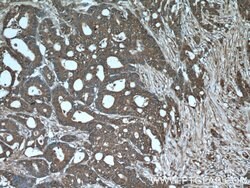 ALDOA Rabbit anti-Human, Mouse, Rat, Polyclonal, Proteintech 150 &mu;L;
