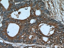 ALDOA Rabbit anti-Human, Mouse, Rat, Polyclonal, Proteintech 150 &mu;L;