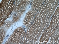 ALDOA Rabbit anti-Human, Mouse, Rat, Polyclonal, Proteintech 150 &mu;L;