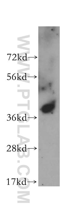 ALDOA Rabbit anti-Human, Mouse, Rat, Polyclonal, Proteintech 150 &mu;L;