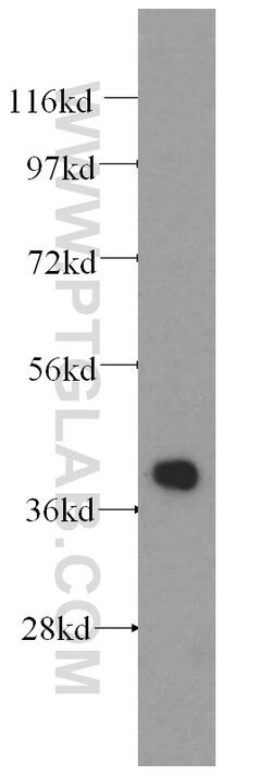 ALDOA Rabbit anti-Human, Mouse, Rat, Polyclonal, Proteintech 150 &mu;L;