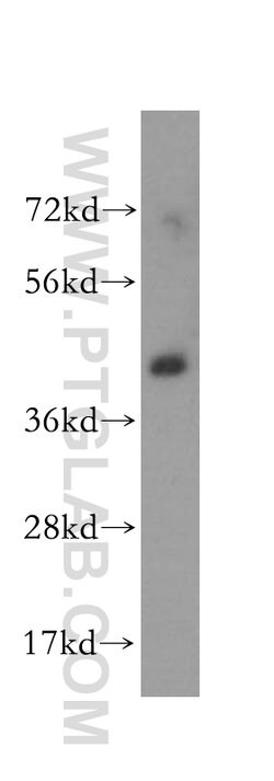 ALDOA Rabbit anti-Human, Mouse, Rat, Polyclonal, Proteintech 150 &mu;L;