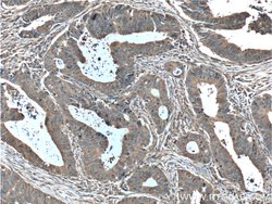 ALDOA Rabbit anti-Human, Mouse, Rat, Polyclonal, Proteintech 150 &mu;L;