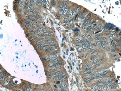 ALDOA Rabbit anti-Human, Mouse, Rat, Polyclonal, Proteintech 150 &mu;L;