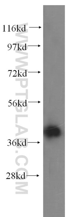 ALDOA Rabbit anti-Human, Mouse, Rat, Polyclonal, Proteintech 150 &mu;L;