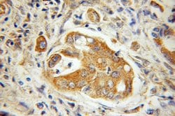 ILVBL Rabbit anti-Human, Mouse, Rat, Polyclonal, Proteintech:Antibodies:Primary