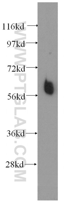 ILVBL Rabbit anti-Human, Mouse, Rat, Polyclonal, Proteintech:Antibodies:Primary