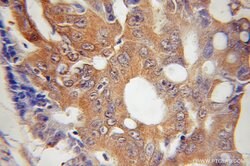 HUS1 Rabbit anti-Human, Polyclonal, Proteintech 150 &mu;L; Unconjugated:Antibodies,