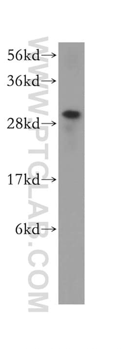 HUS1 Rabbit anti-Human, Polyclonal, Proteintech 150 &mu;L; Unconjugated:Antibodies,