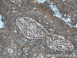 MAP4 Rabbit anti-Human, Mouse, Rat, Polyclonal, Proteintech:Anticuerpos:Anticuerpos
