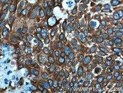 MAP4 Rabbit anti-Human, Mouse, Rat, Polyclonal, Proteintech:Anticuerpos:Anticuerpos