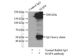 MAP4 Rabbit anti-Human, Mouse, Rat, Polyclonal, Proteintech:Anticuerpos:Anticuerpos