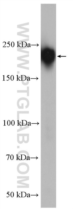 MAP4 Rabbit anti-Human, Mouse, Rat, Polyclonal, Proteintech:Anticuerpos:Anticuerpos