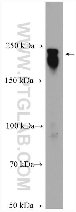 MAP4 Rabbit anti-Human, Mouse, Rat, Polyclonal, Proteintech:Anticuerpos:Anticuerpos