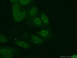 CREB3L1/OASIS Rabbit anti-Human, Mouse, Rat, Polyclonal, Proteintech:Antibodies:Primary