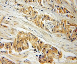 CREB3L1/OASIS Rabbit anti-Human, Mouse, Rat, Polyclonal, Proteintech:Antibodies:Primary