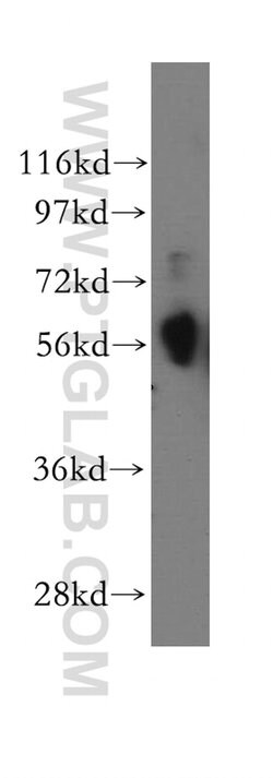 CREB3L1/OASIS Rabbit anti-Human, Mouse, Rat, Polyclonal, Proteintech:Antibodies:Primary