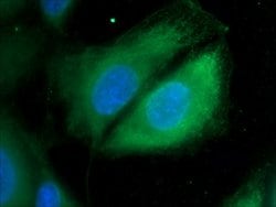 Cathepsin K Rabbit anti-Human, Mouse, Rat, Polyclonal, Proteintech:Antibodies:Primary
