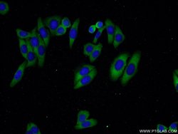 Cathepsin K Rabbit anti-Human, Mouse, Rat, Polyclonal, Proteintech:Antibodies:Primary