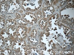 Cathepsin K Rabbit anti-Human, Mouse, Rat, Polyclonal, Proteintech:Antibodies:Primary