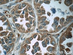 Cathepsin K Rabbit anti-Human, Mouse, Rat, Polyclonal, Proteintech:Antibodies:Primary