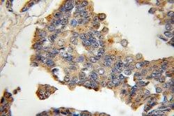 Cathepsin K Rabbit anti-Human, Mouse, Rat, Polyclonal, Proteintech:Antibodies:Primary