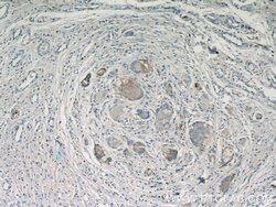 Cathepsin K Rabbit anti-Human, Mouse, Rat, Polyclonal, Proteintech:Antibodies:Primary
