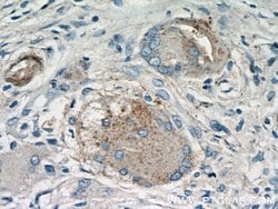 Cathepsin K Rabbit anti-Human, Mouse, Rat, Polyclonal, Proteintech:Antibodies:Primary