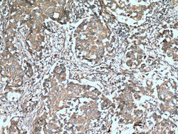 Cathepsin K Rabbit anti-Human, Mouse, Rat, Polyclonal, Proteintech:Antibodies:Primary