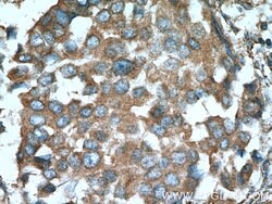 Cathepsin K Rabbit anti-Human, Mouse, Rat, Polyclonal, Proteintech:Antibodies:Primary