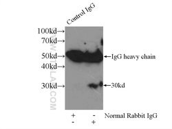 Cathepsin K Rabbit anti-Human, Mouse, Rat, Polyclonal, Proteintech:Antibodies:Primary