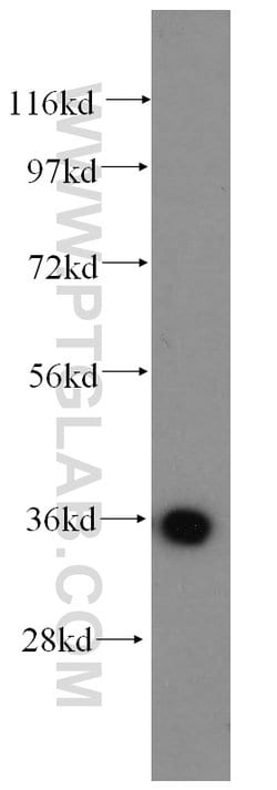 AASDHPPT Rabbit anti-Human, Mouse, Rat, Polyclonal, Proteintech 150 &mu;L;