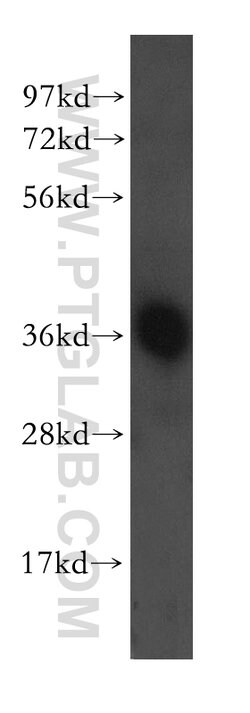 AASDHPPT Rabbit anti-Human, Mouse, Rat, Polyclonal, Proteintech 150 &mu;L;