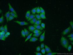 S100A10 Rabbit anti-Human, Mouse, Rat, Polyclonal, Proteintech 150 &mu;L;