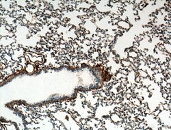 S100A10 Rabbit anti-Human, Mouse, Rat, Polyclonal, Proteintech 150 &mu;L;