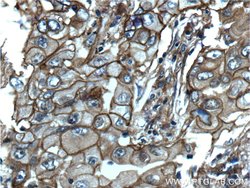 S100A10 Rabbit anti-Human, Mouse, Rat, Polyclonal, Proteintech 150 &mu;L;