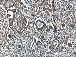 S100A10 Rabbit anti-Human, Mouse, Rat, Polyclonal, Proteintech 150 &mu;L;