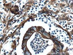 S100A10 Rabbit anti-Human, Mouse, Rat, Polyclonal, Proteintech 150 &mu;L;