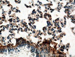 S100A10 Rabbit anti-Human, Mouse, Rat, Polyclonal, Proteintech 150 &mu;L;