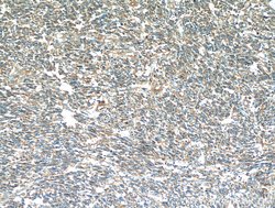 S100A10 Rabbit anti-Human, Mouse, Rat, Polyclonal, Proteintech 150 &mu;L;