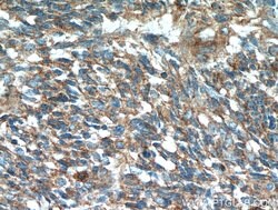 S100A10 Rabbit anti-Human, Mouse, Rat, Polyclonal, Proteintech 150 &mu;L;
