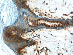 S100A10 Rabbit anti-Human, Mouse, Rat, Polyclonal, Proteintech 150 &mu;L;