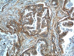 S100A10 Rabbit anti-Human, Mouse, Rat, Polyclonal, Proteintech 150 &mu;L;