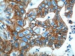 S100A10 Rabbit anti-Human, Mouse, Rat, Polyclonal, Proteintech 150 &mu;L;